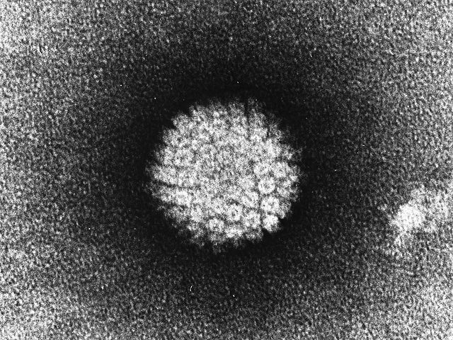 480px-Papilloma_Virus_(HPV)_EM