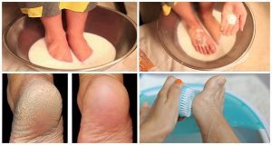 Don’t-Spend-Your-Money-On-Pedicure-Use-Two-Ingredients-From-Your-Kitchen-and-Make-Your-Feet-Look-Nice