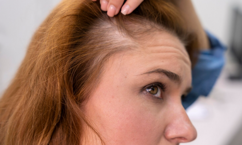 Co znamená, když vám začnou padat vlasy v chomáčích?